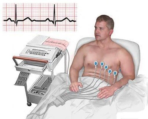 Como é feito o eletrocardiograma? 