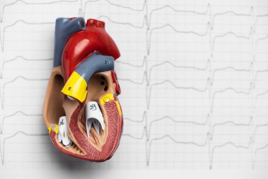 O que é fibrilação atrial?